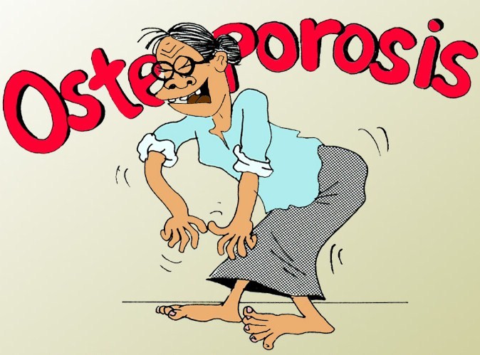 osteoporosis