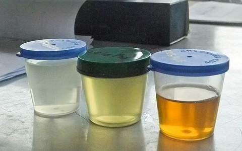 Urine Color